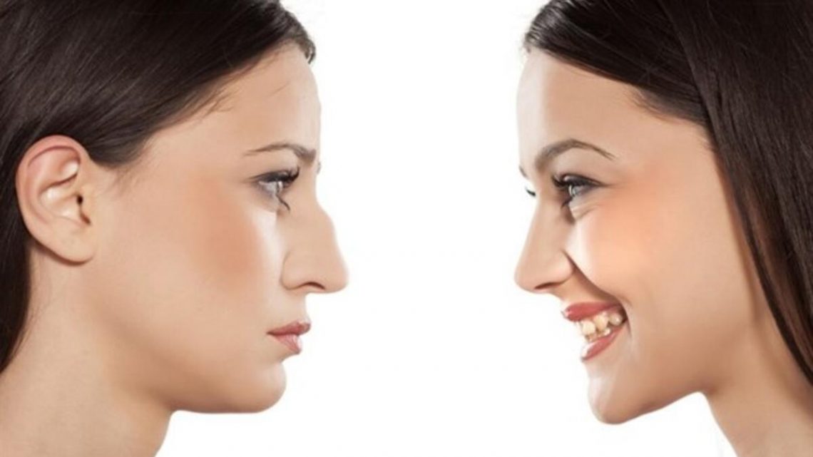 Burun Dolgusu (Liquid Rhinoplasty) Nedir?