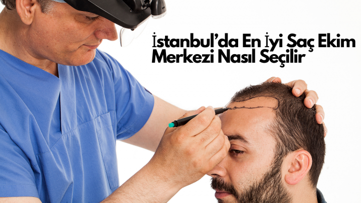 İstanbul’da En İyi Saç Ekim Merkezi Nasıl Seçilir?