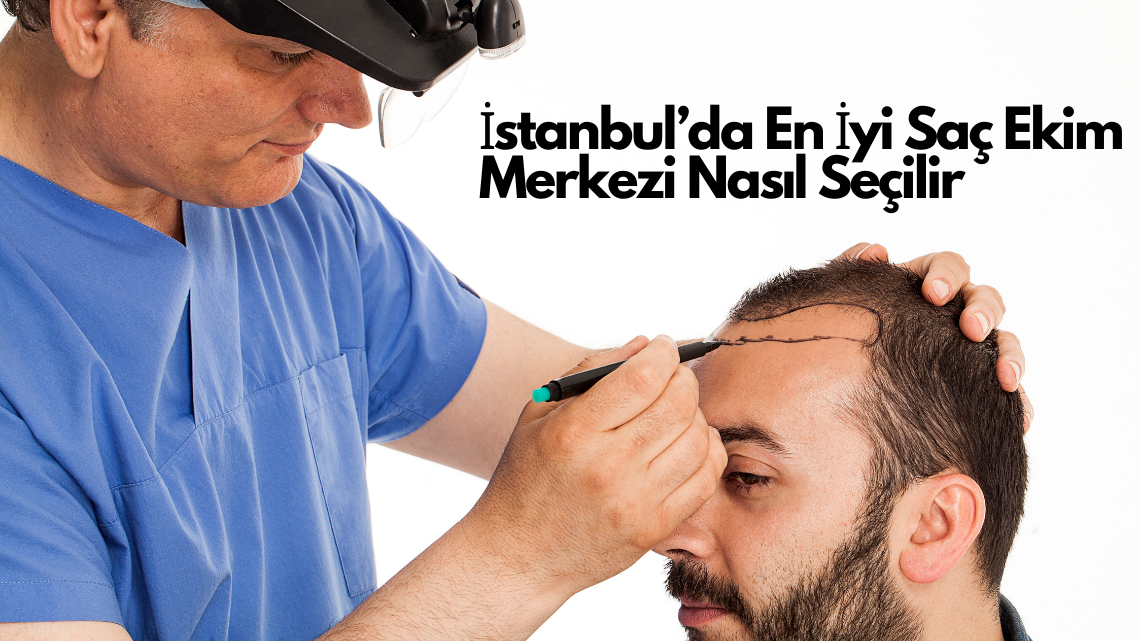 İstanbul’da En İyi Saç Ekim Merkezi Nasıl Seçilir? İstanbul’da En İyi Saç Ekim Merkezi Nasıl Seçilir?