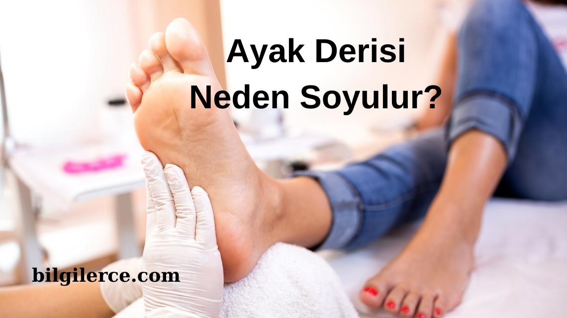 Ayak Derisi Neden Soyulur?